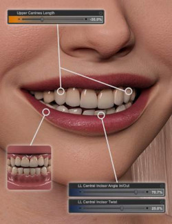 NG Build Your Own Smile for Genesis 9- Dental Work